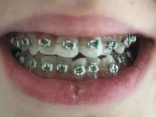 стоматологический центр Profi-Dent в Шали