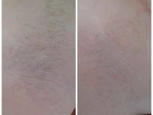 кабинет эпиляции Skin`s в Уссурийске