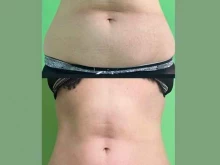 кабинет массажиста Body Sculpt в Буйнакске