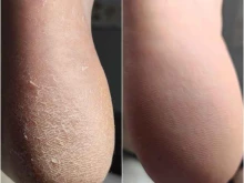 кабинет подолога Foot Care в Краснодаре