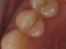 центр семейной стоматологии Dental Implant в Химках