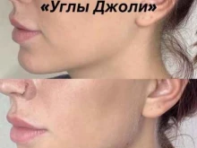 Эпиляция Азбука красоты в Красноярске
