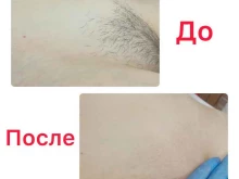 кабинет депиляции Эстетический центр в Верхней Пышме