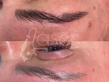 Тату-салоны Studio_laser в Самаре