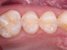 стоматологическая клиника White Clinic в Череповце