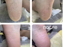 Подолог Кабинет подолога в Нижнем Новгороде