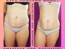 студия коррекции фигуры и обучающий центр Body shaping в Краснодаре
