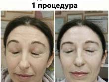 Эпиляция Beauty space в Краснодаре