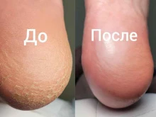 Подолог Студия подологии в Стерлитамаке