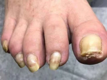 Nxfeet, улица Дорфа, 2 
