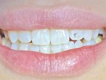 стоматология Adental clinic в Ставрополе