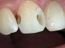 стоматологическая клиника Smile Clinic в Дагестанских Огнях