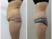 студия коррекции фигуры Slimbody в Казани