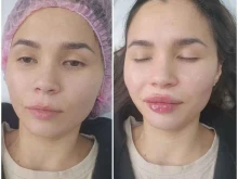 студия косметологии Face в Чебоксарах