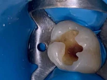 стоматология Айболит в Каспийске