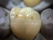 зуботехническая лаборатория Rimlab в Самаре
