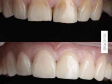 Стоматологические центры IQ dental в Набережных Челнах