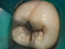 стоматология Мастер-дент в Назрани