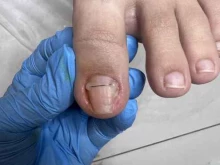 центр подологии и здоровых ногтей DermaFeet в Краснодаре